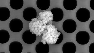 Lab on a Chip Transforms Cancer Diagnosis and Treatment