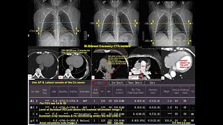 CORONARY CT part 2  2020 edition arabic version