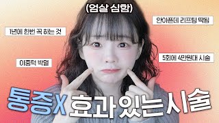 브이라인 싹 됨!!🧒🏻 여태받은 시술들 다 알랴드림 안 아프지만 효과좋은 피부과 시술들