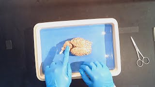 Sheep brain dissection - LIVE