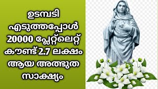 ഉടമ്പടി 20000 താഴെ ഉണ്ടായിരുന്ന പ്ലേറ്റ് ലെറ്റ്‌ കൗണ്ട് 7 മണിക്കൂറിനുള്ളിൽ 2.7 ലക്ഷത്തിൽ എത്തി