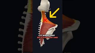 Tight Upper Traps causing Shoulder Pain?