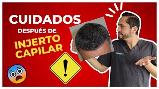 🔴👉🏻3 Cuidados Post  INJERTO CAPILAR | Para NO HACERTE un Injerto 😨😵