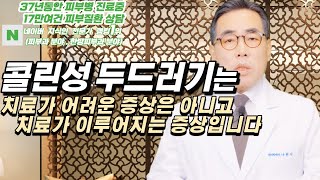 4K)콜린성 두드러기는 원인을 정확하게 파악하면 치료가 되는 증상입니다.