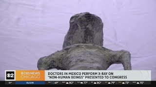 Doctors in Mexico perform x-ray on "non-human beings" presented to Congress