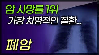 암 사망률 1위, 가장 치명적인 질환 '폐암'의 전조증상은? 🚨 / 부산MBC TV닥터인사이드 150329 방송