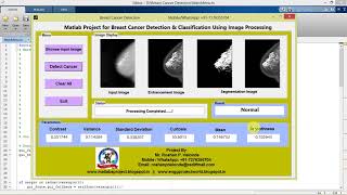 Breast Cancer Detection Using Neural Network Matlab Project with Code || IEEE Based Project