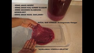 Sirke Anası Nedir (Sirke Anası İle İlgili Her şey)