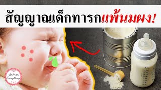 อาการทารก : สัญญาณเด็กทารกแพ้นมผง! | ลูกแพ้นมผง | เด็กทารก Everything