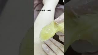 【⚠️閲覧注意⚠️】毛根からゴッソリ取れます！