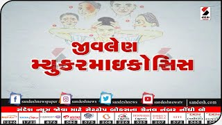 જીવલેણ મ્યુકરમાઈકોસિસ - 09.05.2021 || Sandesh News TV | Cyclone Tauktae