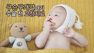 [구순구개열아기] 수술 전 교정치료 받아요