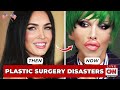 8 Famous Celebrities Unrecognizable After Failed Plastic Surgery - WHO DIED TODAY! NEWS