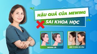 5 HIỆU ỨNG KINH KHỦNG KHI TẬP SAI MEWING VÀ CÁCH KHẮC PHỤC