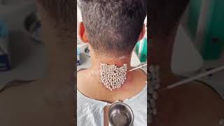 His neck was covered in ticks. 🤒This live broadcast is a pre-recorded event.