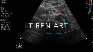 TMT: RENAL DOPPLER PART I