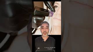 Morpheus8 Radiofrequency Microneedling - Is it Worth It?