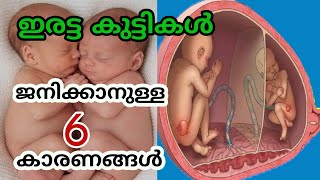 ഇരട്ട കുട്ടികൾ ജനിക്കാനുള്ള 6 കാരണങ്ങൾ // Twins Baby During Pregnancy in Malayalam // Pregnancy Care