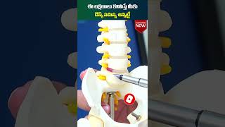 డిస్క్ సమస్య లక్షణాలు | Symptoms of Disc Problems in Back | Socialpost Health | #shorts #healthtips