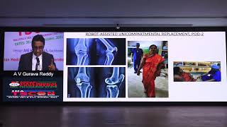 Talk on "Arthritis-Knee-What's New" | 5th Annual State Medical Conference IMA Telangana State|TSCON