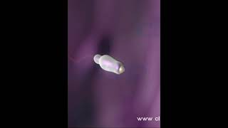 Amazing process of human reproduction 9 - Fertilization ( 3D Animation )