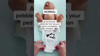 #baby #poop #tips #shorts #shortvideo