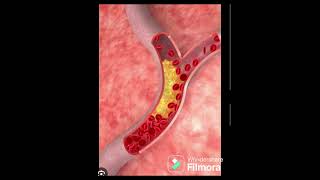 platelet test (ரத்தம் உறைய இதுதான் காரணமா)