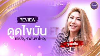 รีวิวดูดไขมันต้นขา คุณ Alice ::: [Siam Loft Clinic]