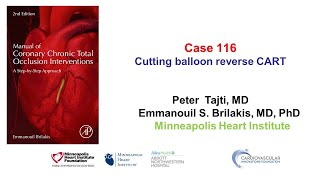 Case 116: Manual of CTO Interventions: Cutting-balloon assisted reverse CART