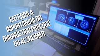 Entenda a importância do diagnóstico precoce do Alzheimer