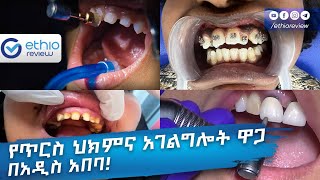 የጥርስ ህክምና አገልግሎት ዋጋ በአዲስ አበባ / Tooth clinic Price in Addis Ababa Ethiopia | Ethio Review