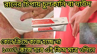 রানের চিপায় চুলকানি বা দাউদ। ৩ দিনে সমাধান ১০০% গেরান্টিক