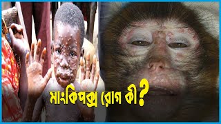 মাংকিপক্স রোগ কী? | Monkeypox | Ekushey ETV