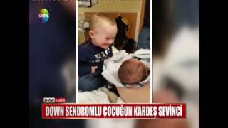 Down sendromlu çocuğun kardeş sevinci