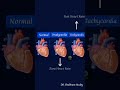 tachycardia vs bradycardia vs normal heart shortsviral biology mbbs