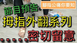 節目預告－ 拇指外翻如何選擇矯形用具|怎樣配戴拇指外翻矯形托