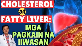 Cholesterol at Fatty Liverl: Mga Pagkain na Iiwasan. - By Doc Willie Ong