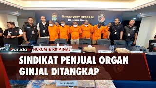 Bravo! 5 Sindikat Penjual Organ Ginjal Berhasil Diamankan!