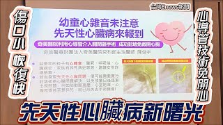 幼童心雜音未注意，先天性心臟病來報到