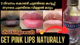 How To Get Pink Lips Naturally | Glycerin For Face \u0026 Lips #pinklips #glycerine #drylips #homeremedy