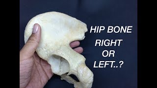 HIP BONE - SIDE DETERMINATION & ANATOMICAL POSITION