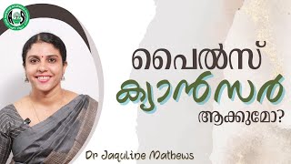 Does piles turns to cancer ? | എല്ലാ പൈൽസും ക്യാൻസർ ആക്കുമോ? | Dr Jaquline Mathews BAMS