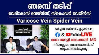 ഞരമ്പ് തടിപ്പ് വെരികോസ് വെയിൽ ഇവയുമായി  ബന്ധപ്പെട്ട സംശയങ്ങൾ ഇപ്പോൾ ഡോക്ടറോട് ലൈവ് ആയി ചോദിക്കാം