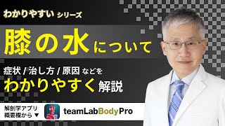 膝の水とは【医師によるわかりやすい解説】