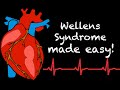 EMS Cardiology || Tachy Tuesday: Wellens Syndrome in EMS