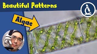 🔬 135 - Where to find beautiful ALGAE with spiral chloroplasts | Amateur Science