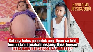 Batang halos pumutok ang tiyan sa laki, kumusta na matapos itampok sa KMJS | Kapuso Mo, Jessica Soho