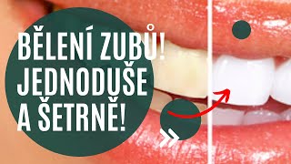 💡Jediné bělení zubů, které Vám ponechá dlouhodobě bílý úsměv a nezničí zuby! ✨