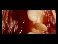 Dusky - Skin Deep (Video)