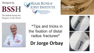 Fixation of distal radius fractures Top 10 tips and tricks by Dr Jorge Orbay